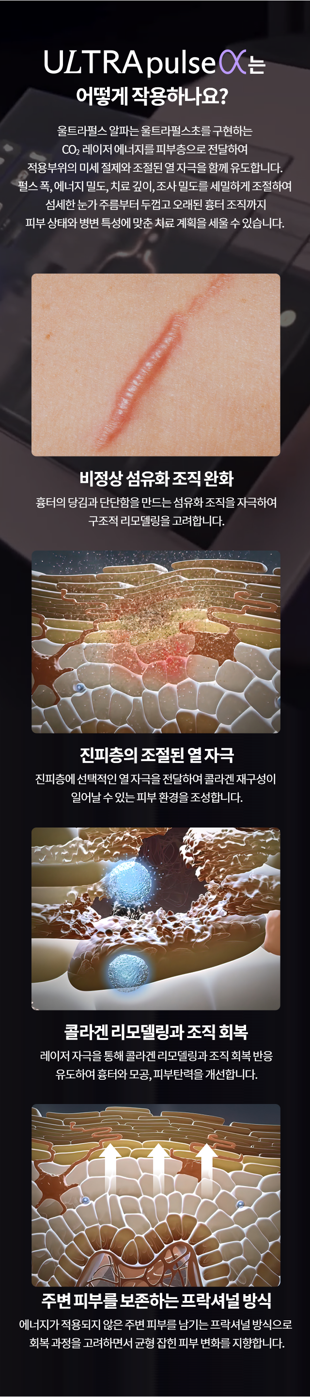 /_files/6G_yRUYt-.png